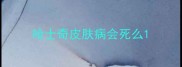 哈士奇皮肤病会死么