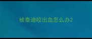 被泰迪咬出血怎么办