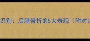 症状识别后腿骨折的5大表现附对比图