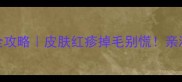 哈士奇真菌感染全攻略皮肤红疹掉毛别慌亲测有效的护理指南