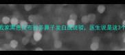 救命我家黑色拉布拉多鼻子发白成斑驳医生说是这3个原因