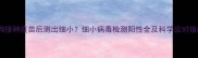 狗狗接种疫苗后测出细小细小病毒检测阳性全及科学应对指南