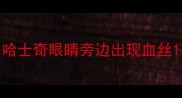 哈士奇眼睛旁边出现血丝