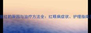 金毛犬眼睛发红的原因与治疗方法全红眼病症状护理指南及预防措施