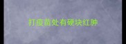 打疫苗处有硬块红肿