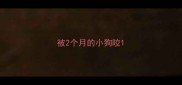 被2个月的小狗咬